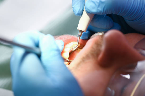 Best Emergency Dental Extractions in Coker, AL