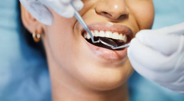 Best Emergency Root Canal Treatment in Coker, AL